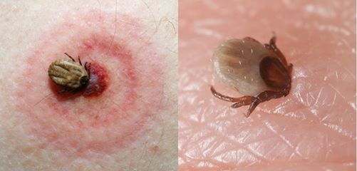 muscatura de capusa
